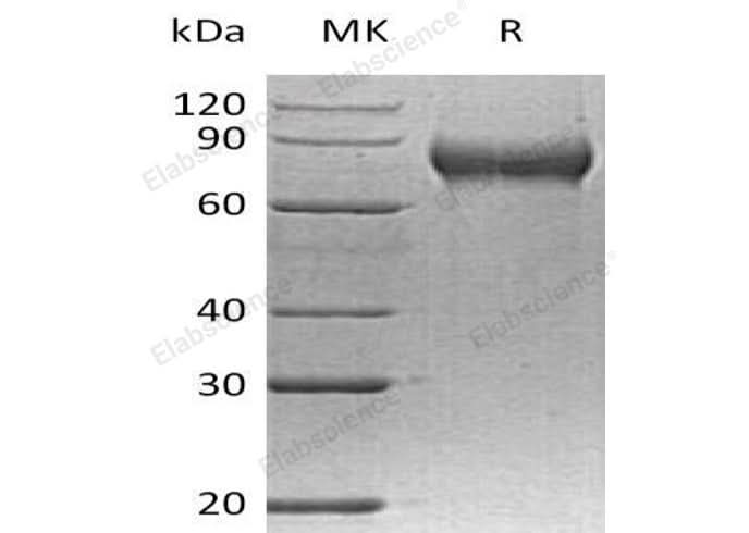 > 98 % as determined by reducing SDS-PAGE.