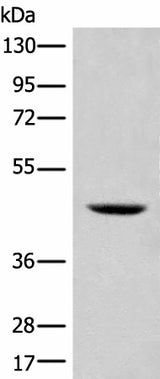 Western blot analysis of 293T cell lysate using SHPK Polyclonal Antibody at dilution of 1:500
