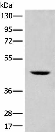 Western blot analysis of 293T cell lysate using SHPK Polyclonal Antibody at dilution of 1:500