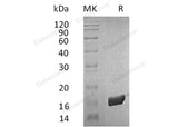 Recombinant Human FKBP2 Protein (His Tag) - ABMIUM