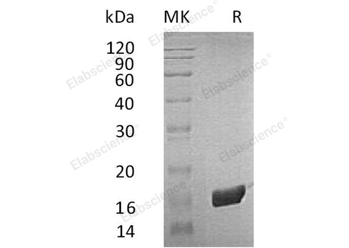 Recombinant Human FKBP2 Protein (His Tag) - ABMIUM