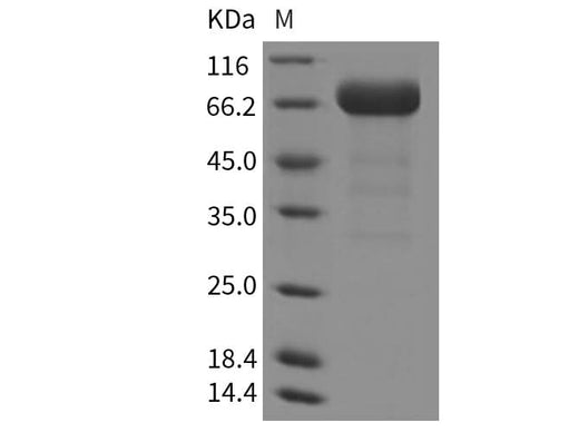 Recombinant Mouse EphA3 Protein (His Tag) - ABMIUM
