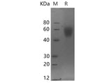 SDS-PAGE analysis of Human MICA proteins, 2 μg/lane of Recombinant Human MICA proteins was resolved with SDS-PAGE under reducing conditions, showing bands at 50-60 kDa.