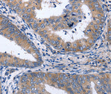 Anti-Human NPPB Antibody - ABMIUM