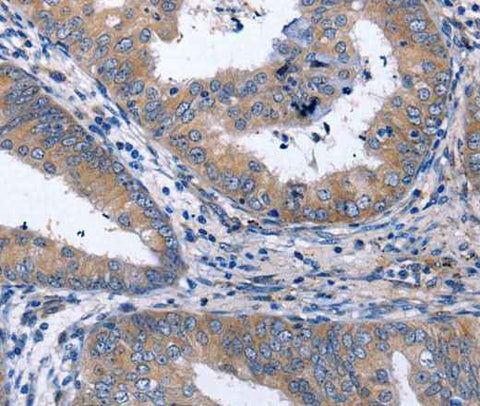 Anti-Human NPPB Antibody