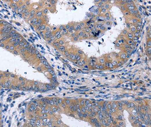 Anti-Human NPPB Antibody