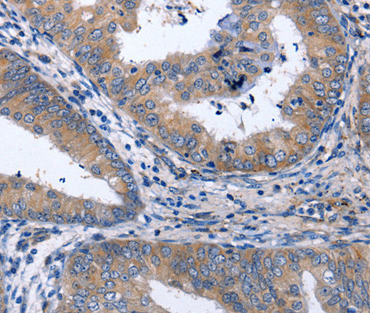 Anti-Human NPPB Antibody - ABMIUM