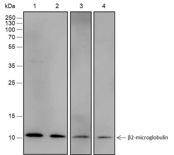Anti-Human/Rat beta-2-Microglobulin Antibody [A561] - ABMIUM