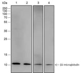 Anti-Human/Rat beta-2-Microglobulin Antibody [A561]