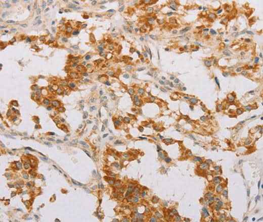 Anti-Human/Mouse/Rat STK40 Antibody