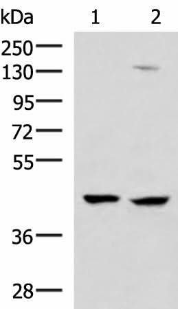 Western blot analysis of 293T and Jurkat cell lysates using MAGEC2 Polyclonal Antibody at dilution of 1:850
