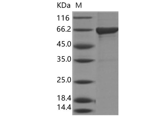 Recombinant Influenza B (B/Florida/4/2006) Nucleoprotein/NP Protein (His Tag) - ABMIUM