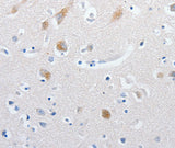 Anti-Human MATN1 Antibody - ABMIUM