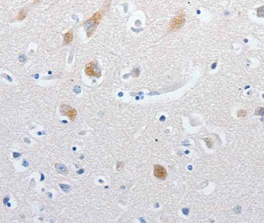 Anti-Human MATN1 Antibody