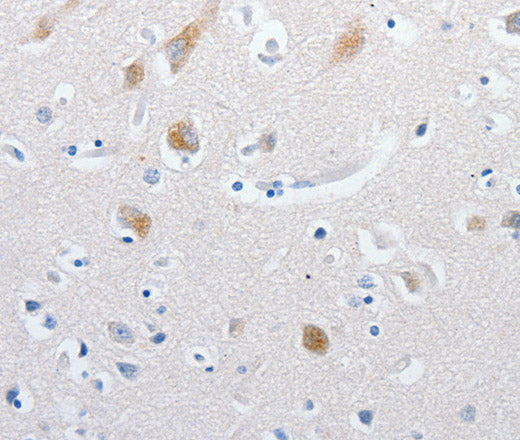 Anti-Human MATN1 Antibody - ABMIUM