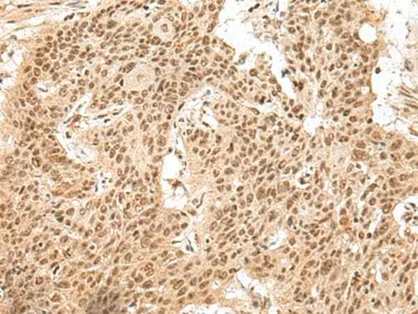 Anti-Human/Mouse/Rat GMEB2 Antibody
