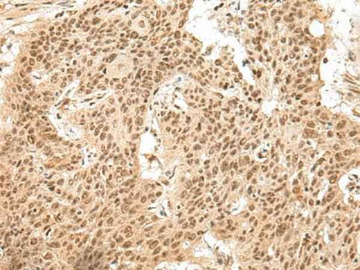 Anti-Human/Mouse/Rat GMEB2 Antibody