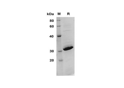 SDS-PAGE analysis of Human SCO2 proteins, 2 μg/lane of Recombinant Human SCO2 proteins was resolved with SDS-PAGE under reducing conditions, showing bands at 31 kDa.
