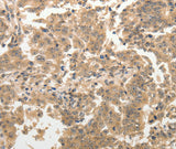 Anti-Human ADAR Antibody - ABMIUM