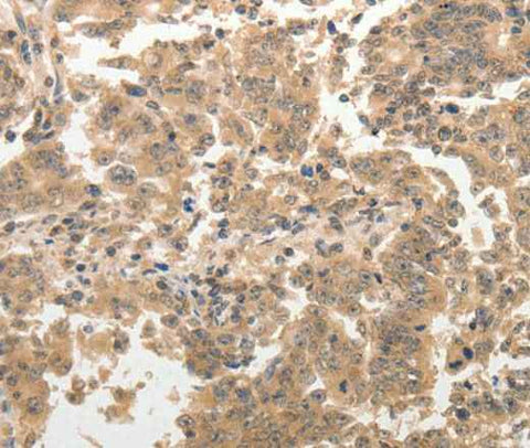Anti-Human ADAR Antibody