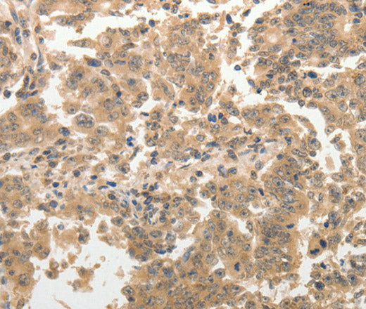 Anti-Human ADAR Antibody - ABMIUM