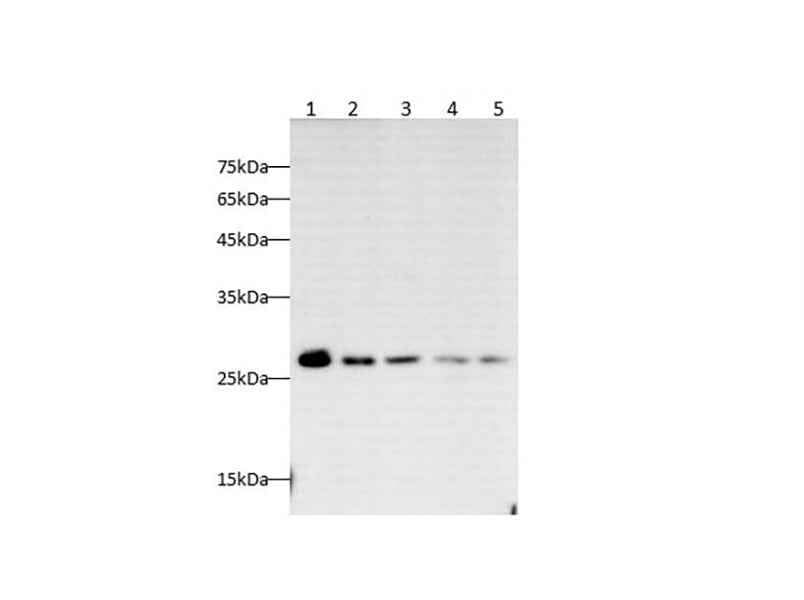 Anti-Human/Mouse/Rat HMGB-1 Antibody - ABMIUM