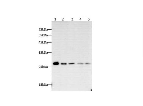 Anti-Human/Mouse/Rat HMGB-1 Antibody - ABMIUM