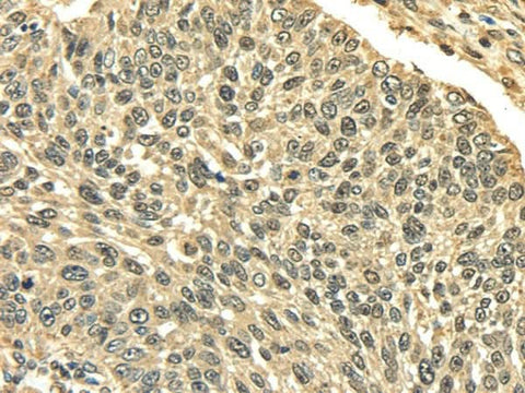 Anti-Human PLIN3 Antibody - ABMIUM