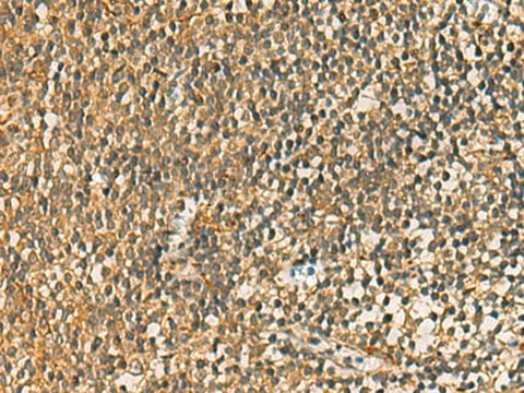 Anti-Human FAAP100 Antibody - ABMIUM
