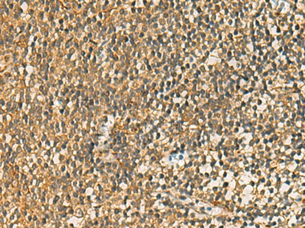 Anti-Human FAAP100 Antibody - ABMIUM