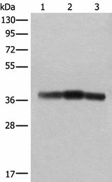 Western blot analysis of Rat brain tissue Mouse brain tissue and Human cerebrum tissue lysates using ATAD1 Polyclonal Antibody at dilution of 1:800