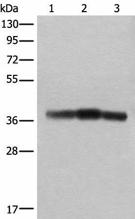 Western blot analysis of Rat brain tissue Mouse brain tissue and Human cerebrum tissue lysates using ATAD1 Polyclonal Antibody at dilution of 1:800