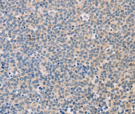Anti-Human/Mouse/Rat CD56 Antibody - ABMIUM