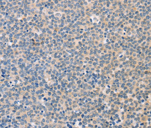 Anti-Human/Mouse/Rat CD56 Antibody - ABMIUM