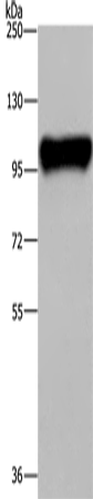 Anti-Human/Mouse/Rat PTK2B Antibody - ABMIUM