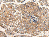 Anti-Human/Mouse/Rat CACNA2D2 Antibody - ABMIUM