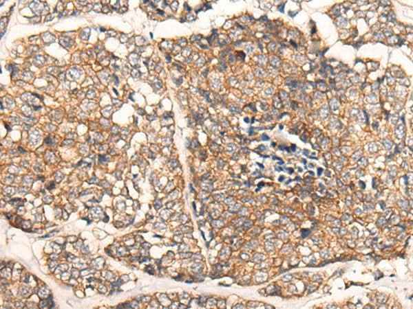 Anti-Human/Mouse/Rat CACNA2D2 Antibody