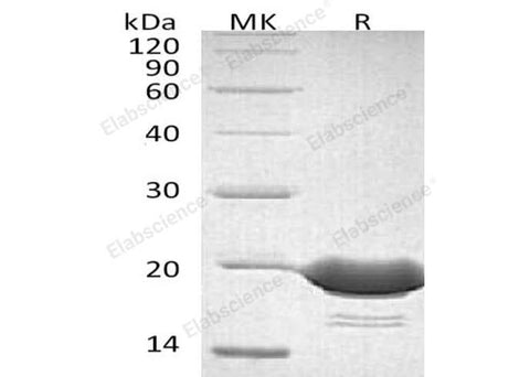 Recombinant Human 4-1BBL/TNFSF9 Protein (His Tag) - ABMIUM