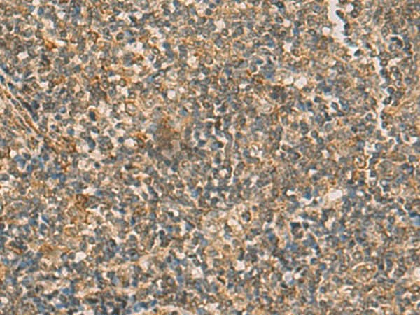 Immunohistochemistry of paraffin-embedded Human tonsil tissue using IFT22 Polyclonal Antibody at dilution of 1:50(×200)