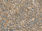 Immunohistochemistry of paraffin-embedded Human tonsil tissue using IFT22 Polyclonal Antibody at dilution of 1:50(×200)
