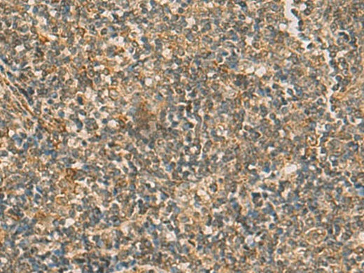 Immunohistochemistry of paraffin-embedded Human tonsil tissue using IFT22 Polyclonal Antibody at dilution of 1:50(×200)