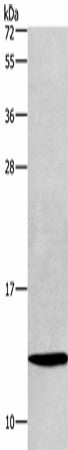 Anti-Human/Mouse/Rat HINT1 Antibody - ABMIUM