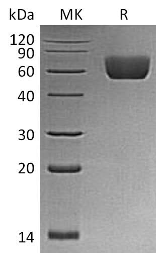 Recombinant Mouse BTNL2/Butyrophilin-like Protein 2 Protein (His Tag) - ABMIUM
