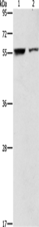 Anti-Human/Mouse/Rat ARHGAP15 Antibody - ABMIUM
