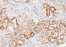 Anti-Human LRPAP1 Antibody [A1055] - ABMIUM