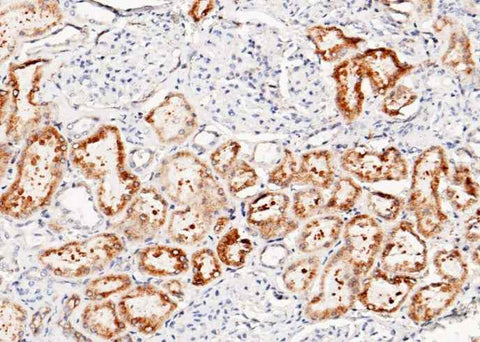 Anti-Human LRPAP1 Antibody [A1055] - ABMIUM