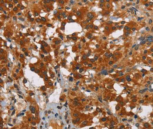 Anti-Human SMAD9 Antibody
