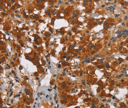 Anti-Human SMAD9 Antibody - ABMIUM