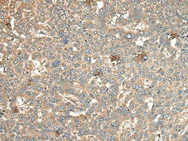 Anti-Human/Mouse CA11 Antibody