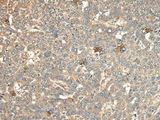 Anti-Human/Mouse CA11 Antibody